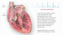 8621_Normal_Heart.